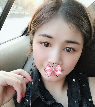 重庆超雅超声波去眼袋,变得美美的336 重庆超雅超声波去眼袋,变得美美的336