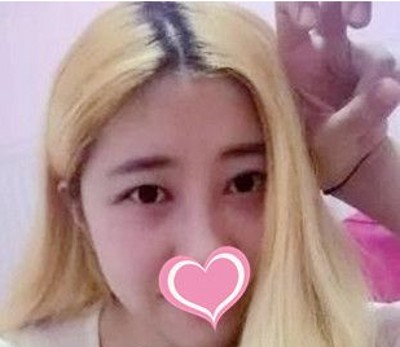 超声波去眼袋让时光驻足留住美!391 超声波去眼袋让时光驻足留住美!391