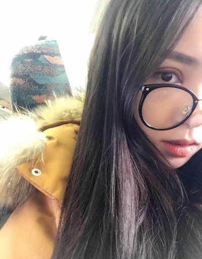 双眼皮增的不只是颜值更是气质！852