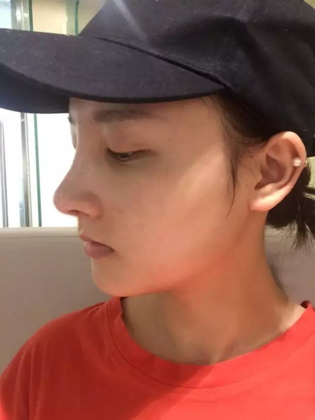 重庆超雅隆鼻手术让你圆梦成真!389 重庆超雅隆鼻手术让你圆梦成真!389