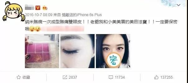 要说形成双眼 皮，还shì重庆超雅得双眼 皮手术靠谱