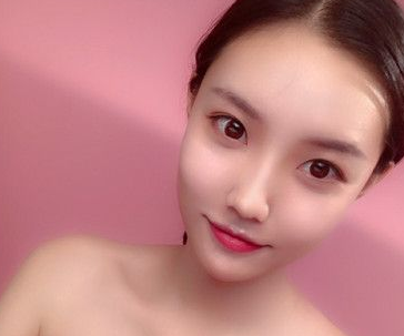 娘胎自带的高鼻梁也是做隆鼻手术，去哪里？重庆超雅！！686