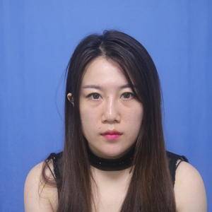 超 声 波去眼袋棒棒哒,感谢梁医生 超 声 波去眼袋棒棒哒,感谢梁医生