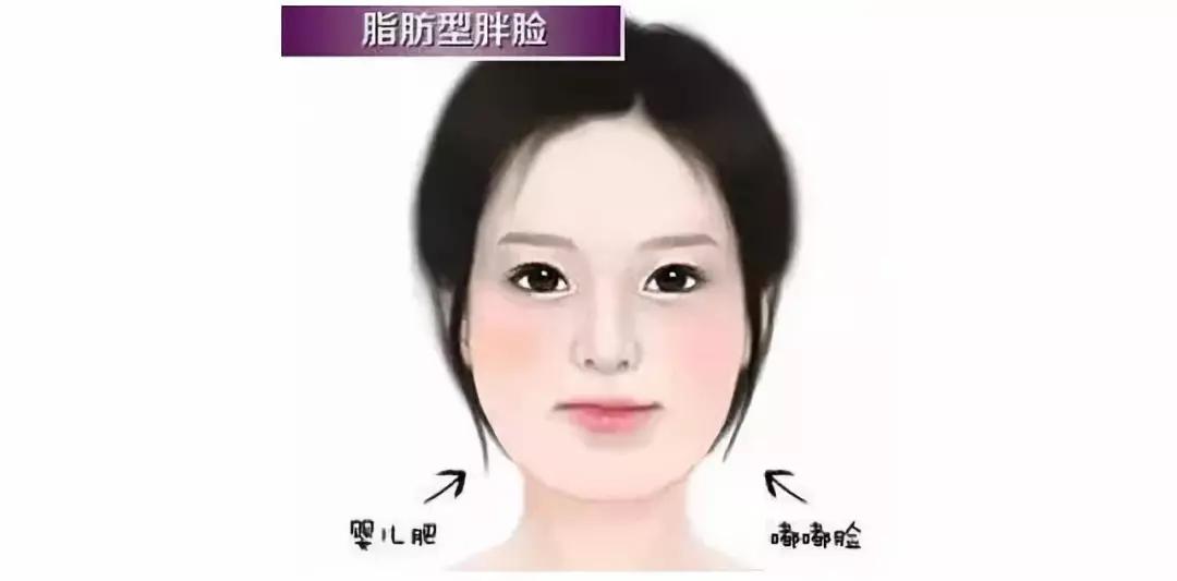 超声波瘦脸