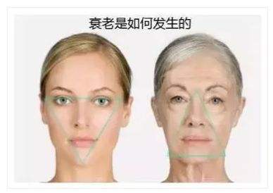 超雅整形医院的面部提升术帮我消除了木偶纹263 超雅整形医院的面部提升术帮我消除了木偶纹263
