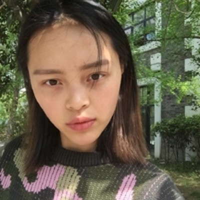 让我自信起来的去眼袋手术,超声波去眼袋851 让我自信起来的去眼袋手术,超声波去眼袋851