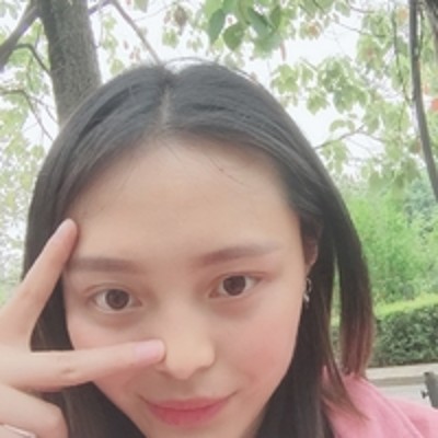 让我自信起来的去眼袋手术,超声波去眼袋851 让我自信起来的去眼袋手术,超声波去眼袋851