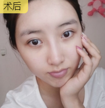 去眼袋哪招最好?重庆超雅去眼袋手术!583 去眼袋哪招最好?重庆超雅去眼袋手术!583