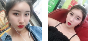 去眼袋哪招最好?重庆超雅去眼袋手术!583 去眼袋哪招最好?重庆超雅去眼袋手术!583