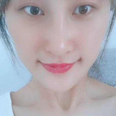 超声波去眼袋,去掉眼袋完美恢复。248 超声波去眼袋,去掉眼袋完美恢复。248