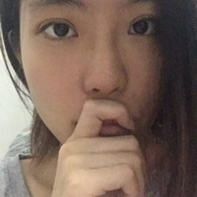去眼袋的好办法,超声波去眼袋。128 去眼袋的好办法,超声波去眼袋。128