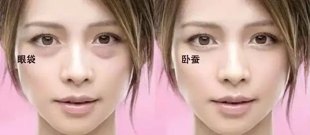 现代人生活压力大,眼袋形成怎么办?126 现代人生活压力大,眼袋形成怎么办?126