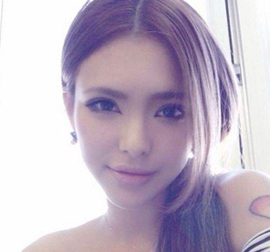 超 声 波双眼 皮手术可以解决肿泡眼 超 声 波双眼 皮手术可以解决肿泡眼