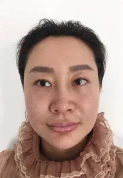 带着妈妈去做超声波去眼袋,去眼袋670 带着妈妈去做超声波去眼袋,去眼袋670