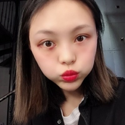超声波去眼袋,年轻伴我左右380 超声波去眼袋,年轻伴我左右380