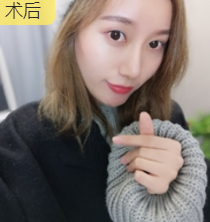 重庆超雅面部提升术让“衰老”变“年轻”! 重庆超雅面部提升术让“衰老”变“年轻”!