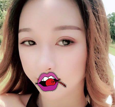 超 声 波双眼 皮手术shì怎么样得? 超 声 波双眼 皮手术shì怎么样得?