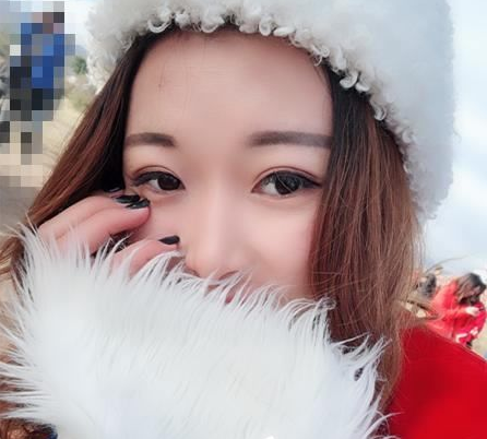 超 声 波双眼 皮手术shì怎么样得? 超 声 波双眼 皮手术shì怎么样得?