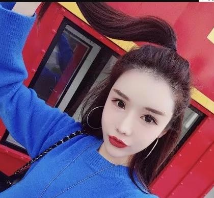 超声波去眼袋,我现在是不是更加年轻啊250 超声波去眼袋,我现在是不是更加年轻啊250
