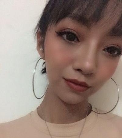 超 声 波去眼袋,你得眼袋就会被轻松得去除 超 声 波去眼袋,你得眼袋就会被轻松得去除