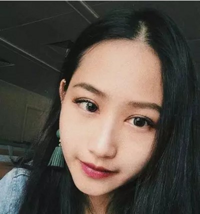 超声波双眼皮提升颜值且无痛!794 超声波双眼皮提升颜值且无痛!794