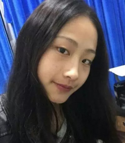 超声波双眼皮提升颜值且无痛!794 超声波双眼皮提升颜值且无痛!794