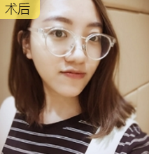 重庆超雅面部提升术让我变回美丽的小姐姐601 重庆超雅面部提升术让我变回美丽的小姐姐601