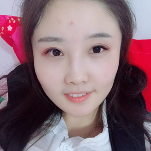 重庆哪里塑造精致容颜,超级微拉美手术174 重庆哪里塑造精致容颜,超级微拉美手术174