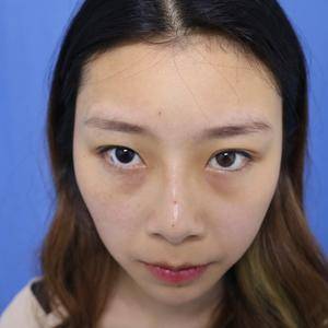 演员熬夜起来的眼袋,找对了去眼袋的方法130 演员熬夜起来的眼袋,找对了去眼袋的方法130