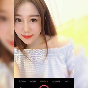 不开刀去掉眼袋真的很满意,谢谢超声波去眼袋788 不开刀去掉眼袋真的很满意,谢谢超声波去眼袋788