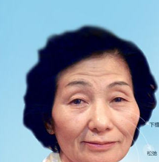 要想美就来重庆超雅做面部提升术吧 要想美就来重庆超雅做面部提升术吧