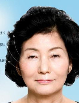 要想美就来重庆超雅做面部提升术吧 要想美就来重庆超雅做面部提升术吧