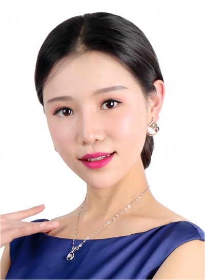 超 声 波去眼袋，没le眼袋后，人生处处有惊喜
