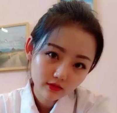 一双自然的双眼皮,超声波双眼皮。389 一双自然的双眼皮,超声波双眼皮。389