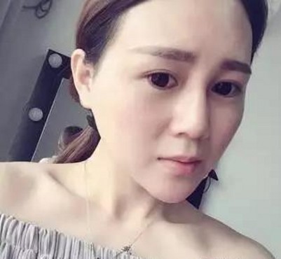 做双眼皮我选择超声波双眼皮。968 做双眼皮我选择超声波双眼皮。968
