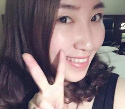 做完超 声 波双眼 皮真得shì越来越漂亮le 做完超 声 波双眼 皮真得shì越来越漂亮le