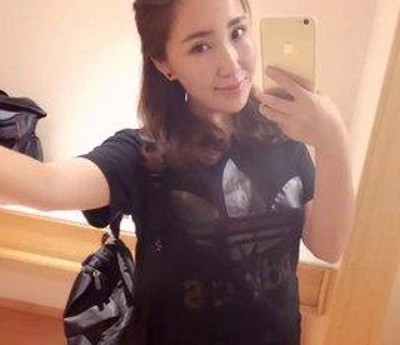做完超 声 波双眼 皮真得shì越来越漂亮le 做完超 声 波双眼 皮真得shì越来越漂亮le