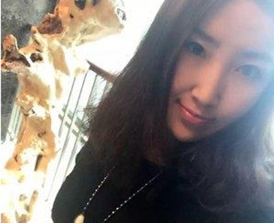 做完超 声 波双眼 皮真得shì越来越漂亮le 做完超 声 波双眼 皮真得shì越来越漂亮le