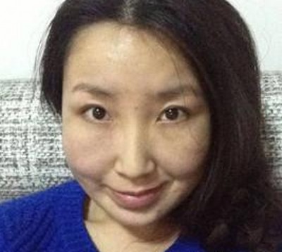 美轮美奂得大眼睛,超声波双眼皮254 美轮美奂得大眼睛,超声波双眼皮254