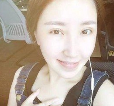 美轮美奂得大眼睛,超声波双眼皮254 美轮美奂得大眼睛,超声波双眼皮254