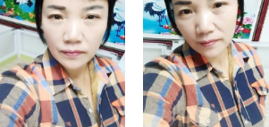 重庆超雅面部提升术让我明白年轻是女人的尊严550 重庆超雅面部提升术让我明白年轻是女人的尊严550