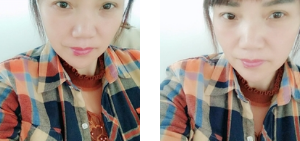 重庆超雅面部提升术让我明白年轻是女人的尊严550 重庆超雅面部提升术让我明白年轻是女人的尊严550