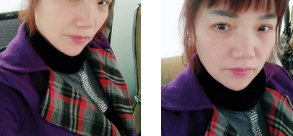 重庆超雅面部提升术让我明白年轻是女人的尊严550 重庆超雅面部提升术让我明白年轻是女人的尊严550