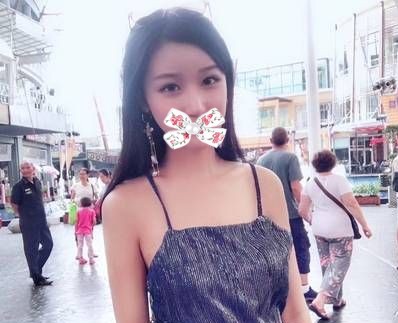 超声波双眼皮一抹我心中之阴霾209 超声波双眼皮一抹我心中之阴霾209