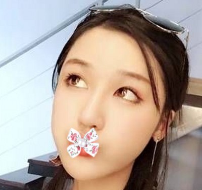 超声波双眼皮一抹我心中之阴霾209 超声波双眼皮一抹我心中之阴霾209
