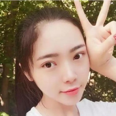 超声波双眼皮,真的越来越漂亮了!656 超声波双眼皮,真的越来越漂亮了!656