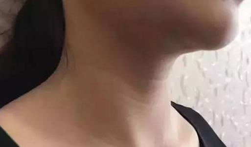 颈纹像年轮？丑哭！抹掉颈纹你需要它——超级微拉美752
