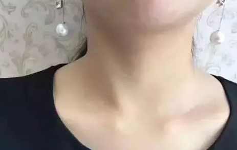 颈纹像年轮？丑哭！抹掉颈纹你需要它——超级微拉美752