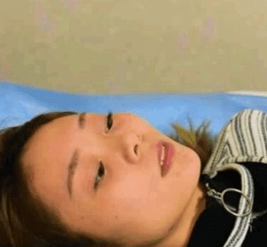 自体脂肪填充术→春节过后献给自己最好的礼物！275