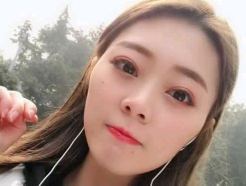 自体脂肪填充术→春节过后献给自己最好的礼物！275